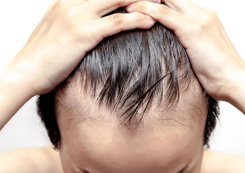 عمليات زراعة الشعر في تركيا بالليزر للرجال