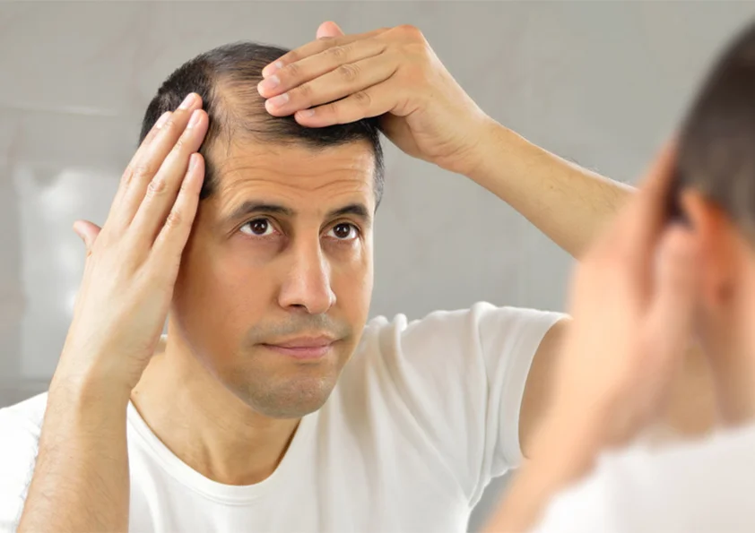 عمليات زراعة الشعر في تركيا بالليزر للنساء