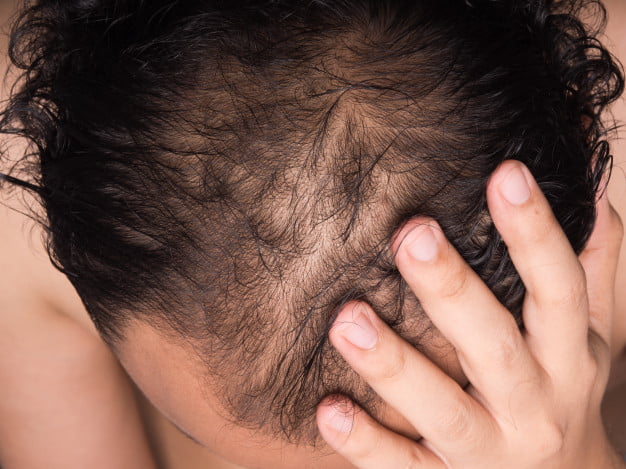 طريقة علاج الشعر الجاف